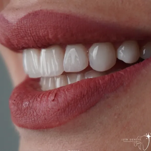 Before and After Treatment 1