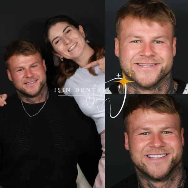 Before and After Treatment 10