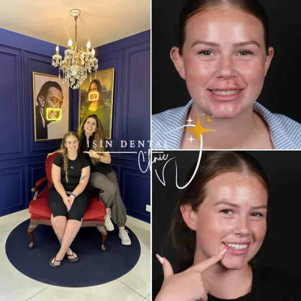 Before and After Treatment 12