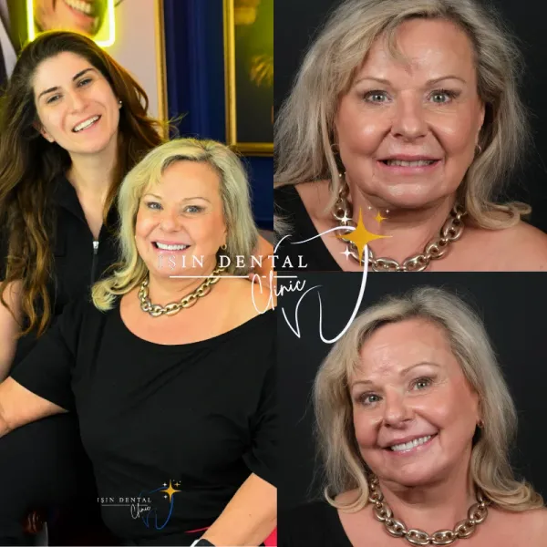 Before and After Treatment 14