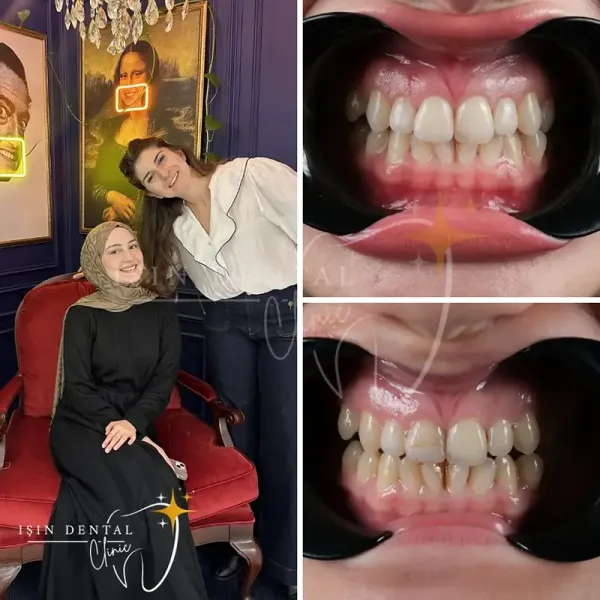 Before and After Treatment 3