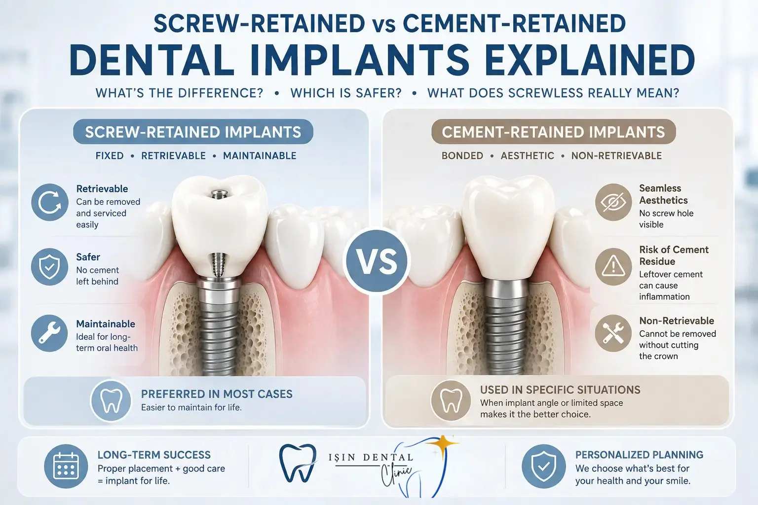 Screw-Retained vs Cement-Retained Implants in Antalya, Turkey